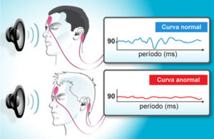 Qué es hipoacusia neurosensorial y cuáles son sus causas Doctora