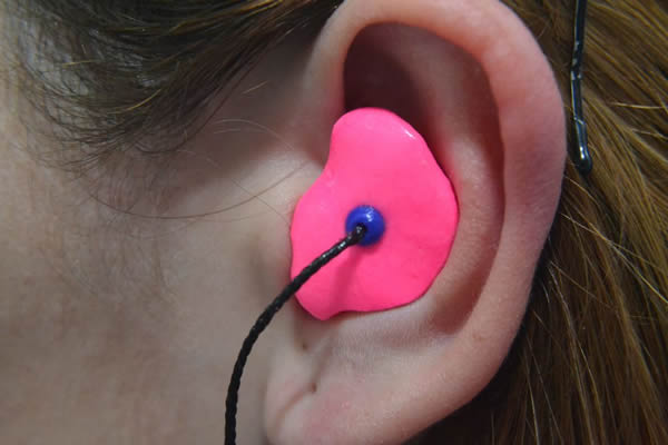 Opciones para el tratamiento de orejas con formas anormales en
